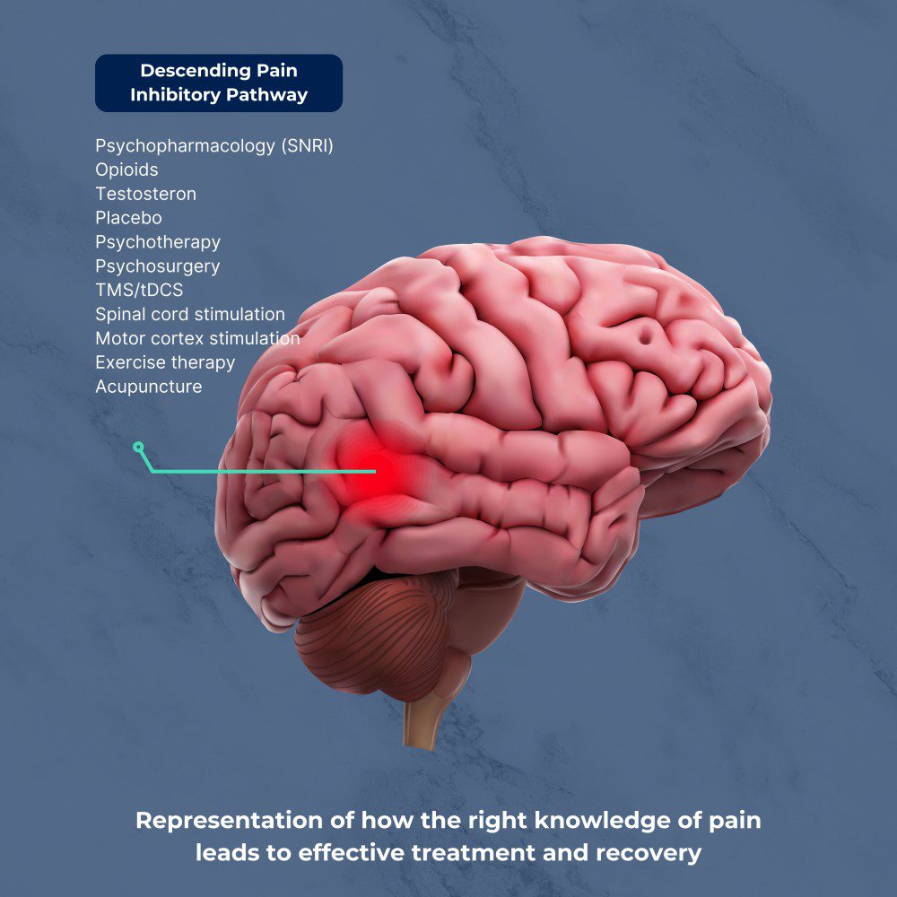 Descending Pain Inhibitory Pathway