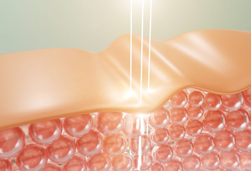 Enhanced Blood Flow and Neovascularization