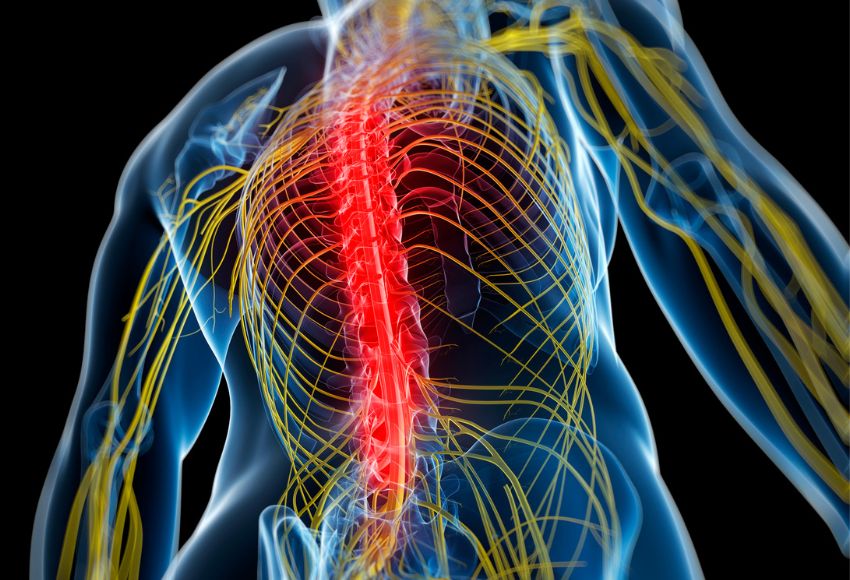 Lumbar Radiculopathy