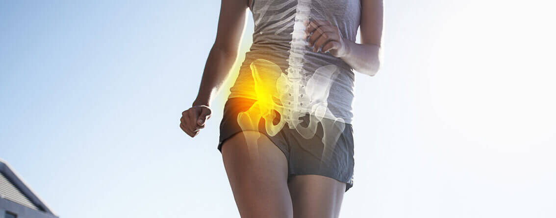 Woman running with her hip bone lit up in yellow due to hip pain.